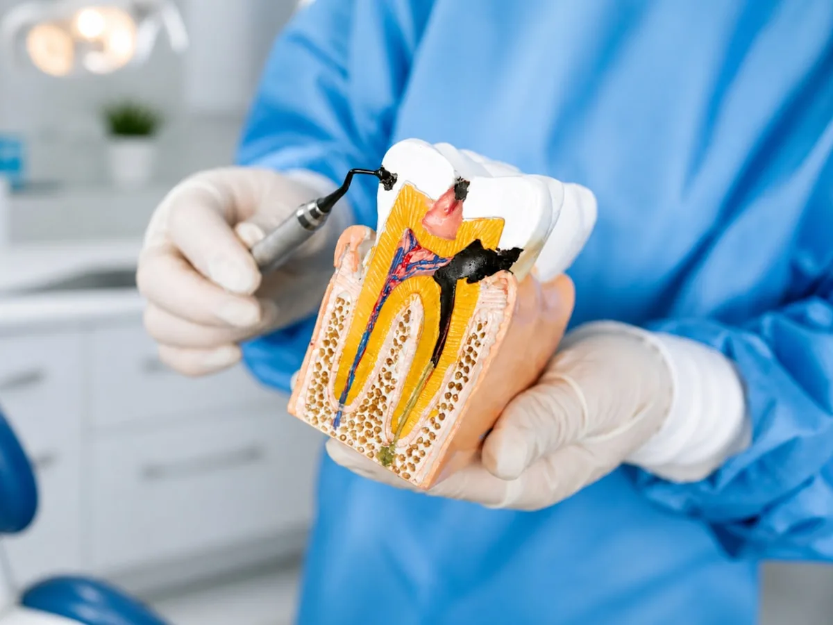 Dentist holding a cross-section tooth model explaining root canal anatomy